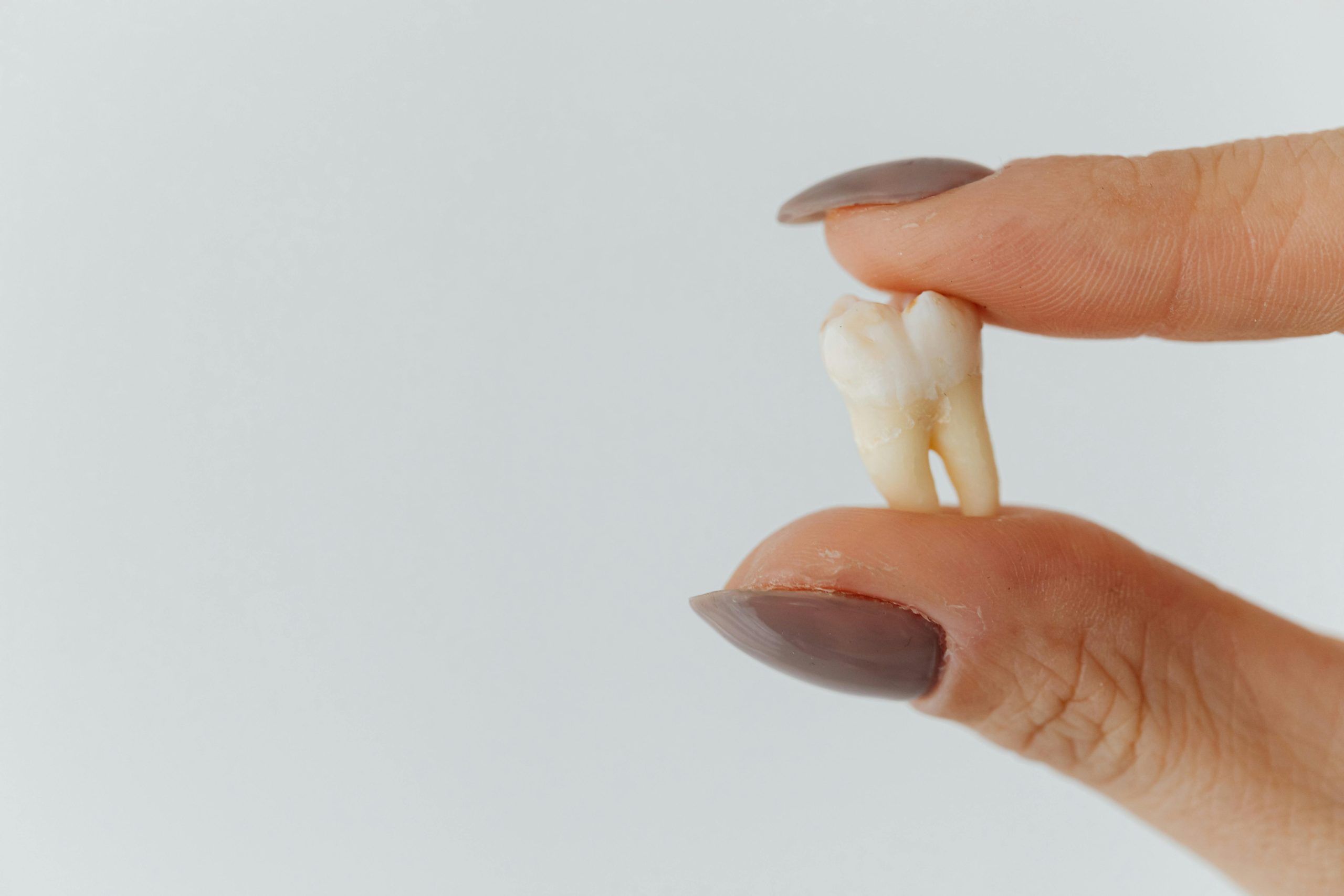 Detailed shot of a dentist applying veneer to a woman's teeth during a dental procedure.