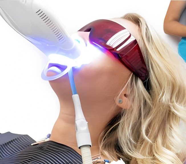Detailed shot of a dentist applying veneer to a woman's teeth during a dental procedure.
